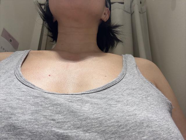 ミカ 1
