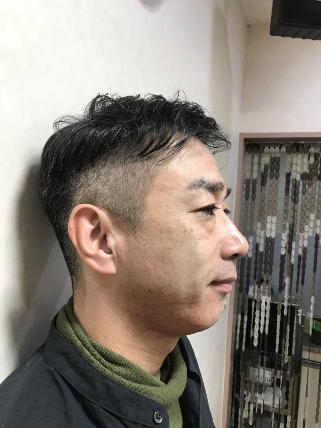 iga 1