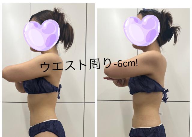 痩身上半身75分(広告掲載モデル)