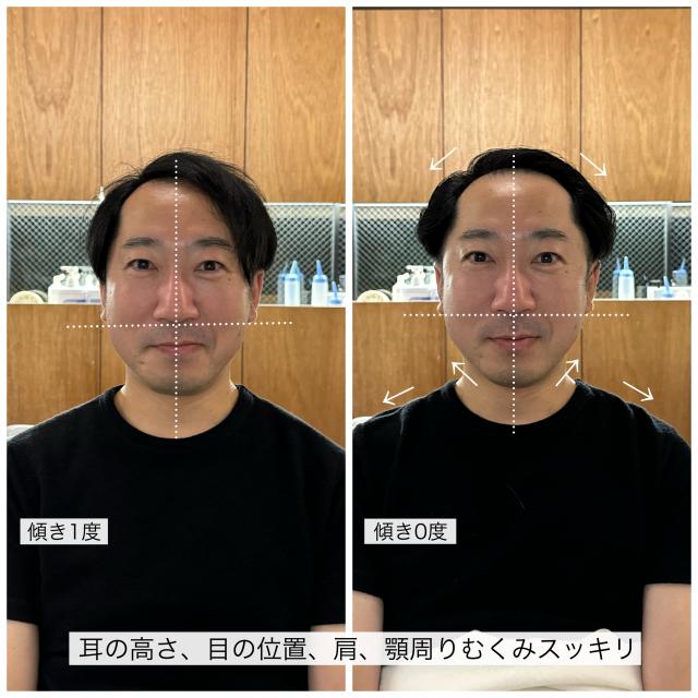骨格補正スパ