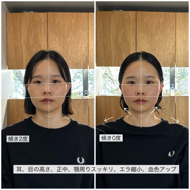 リピーター様
骨格補正スパ