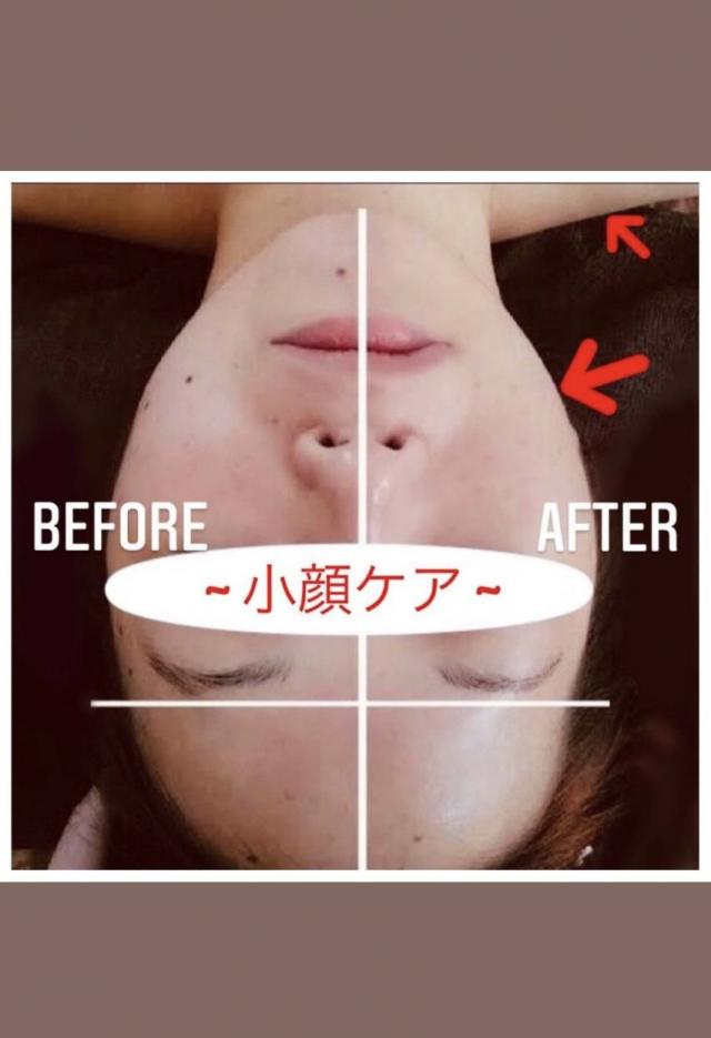 芸能人も使用してる美顔器を使用したフェイシャルメニュー!