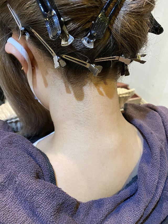 【サロンで簡単にできちゃう✨】うなじ脱毛