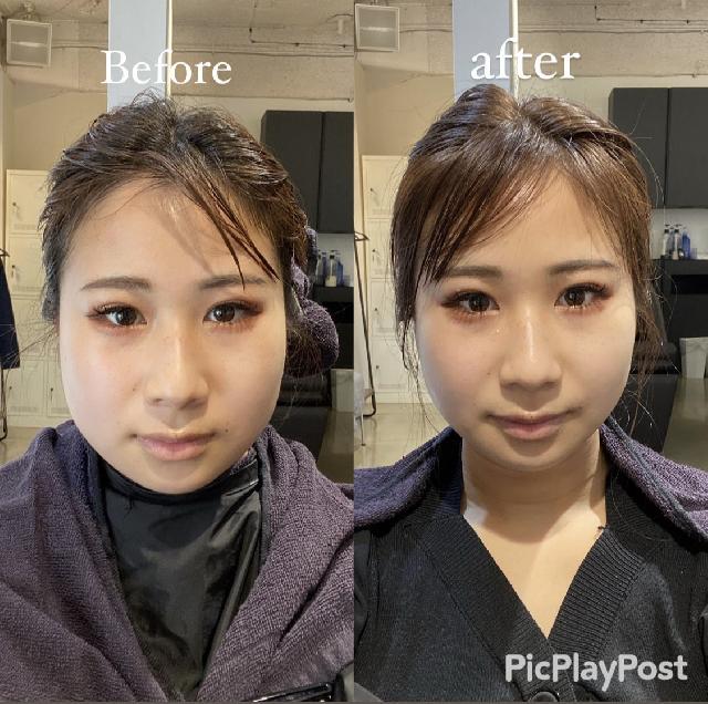 骨格補正小顔スパ